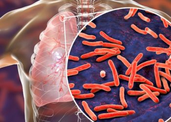 Diagnóstico rápido da tuberculose