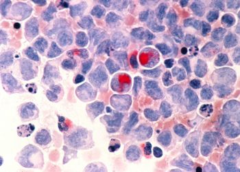 Terapia celular para tratamento de câncer